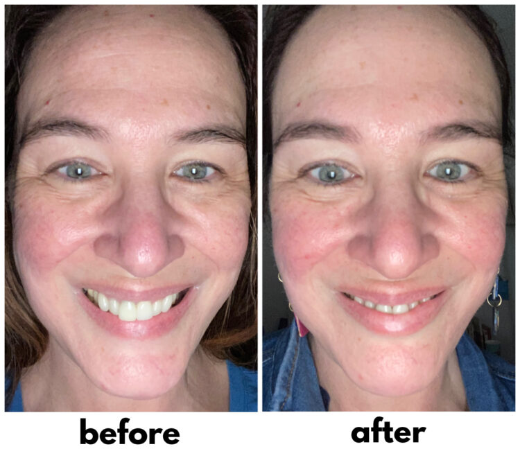 Over 40 Trinny London Skincare Review 9 trinny london skincare review over 40 skin before and after